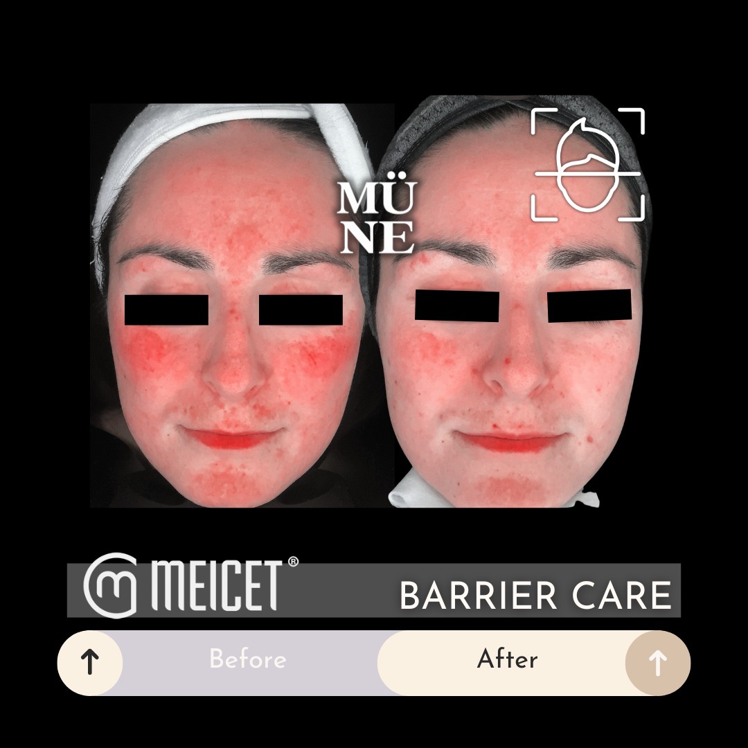 Mune Aesthetics Facebook ad: Barrier repair isn’t a trend.