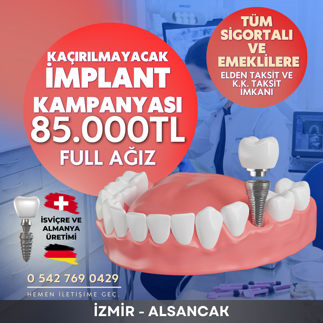 Ege Diş Sağlığı Merkezi Facebook ad: Full Ağız İmplant 85.000TL