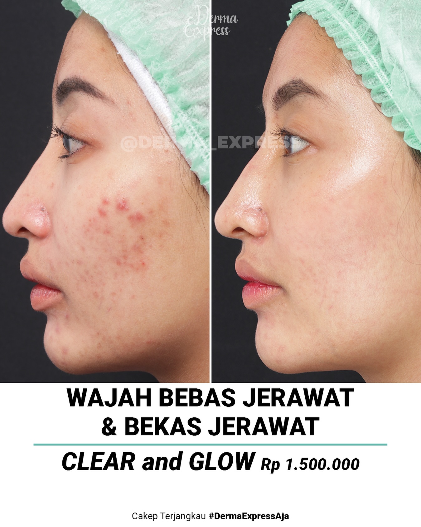 derma_express Facebook ad