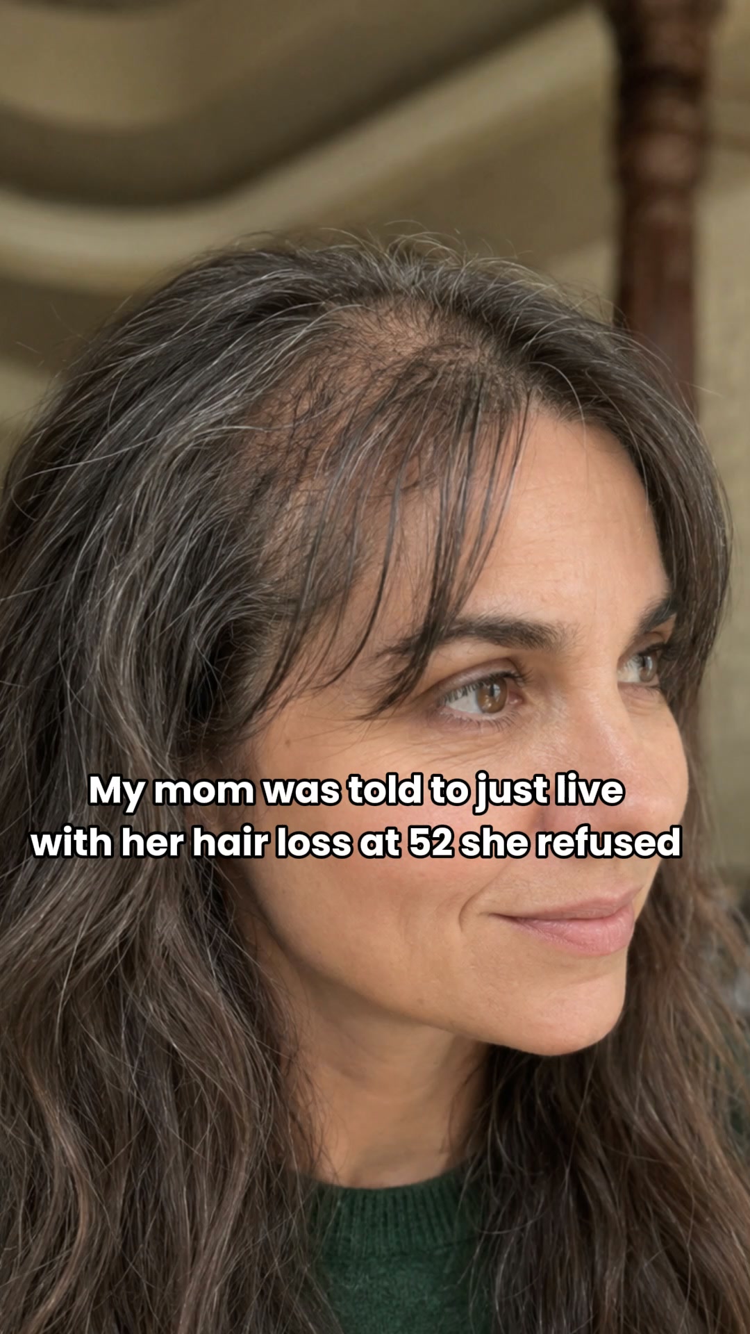 Bloom & Bond Facebook ad: Help Hair Loss Naturally