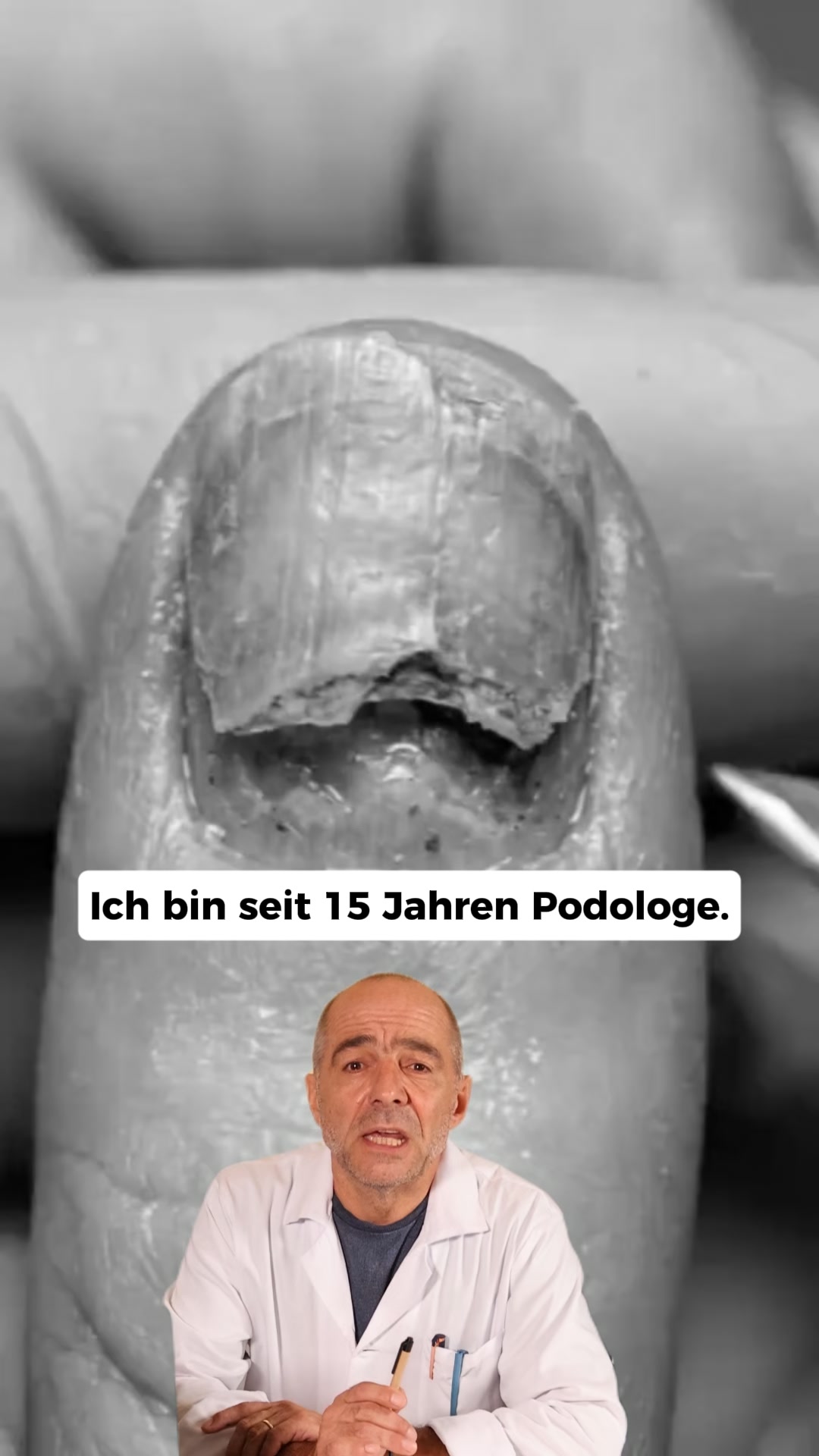 Nagelpilz Ratgeber Facebook ad: Der größte Fehler bei Nagelpilz