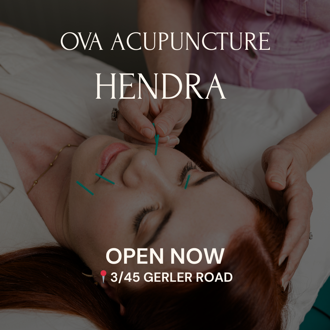 Ova Acupuncture and Chinese Medicine Facebook ad from Feb 9, 2026