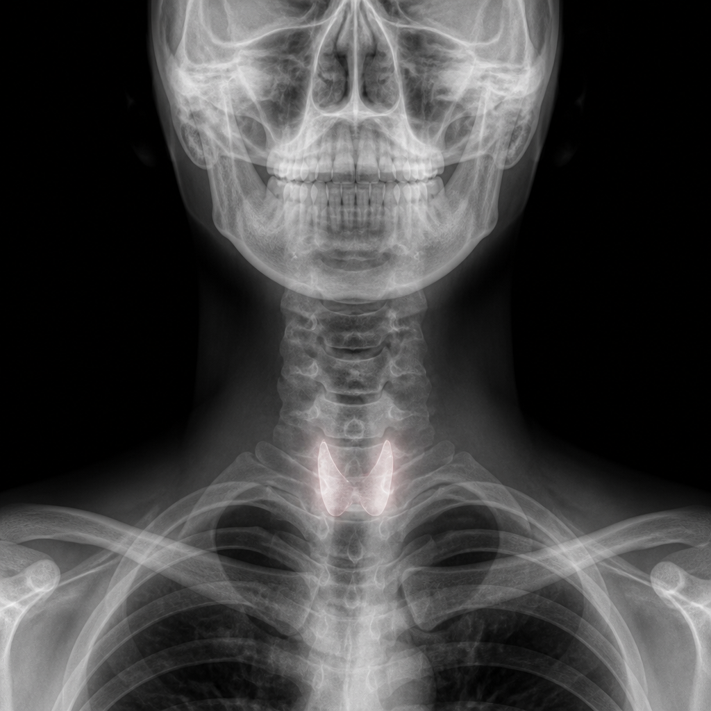 Living Well with Diana Facebook ad: The Secret Hormone Behind Thyroid Weight Gain