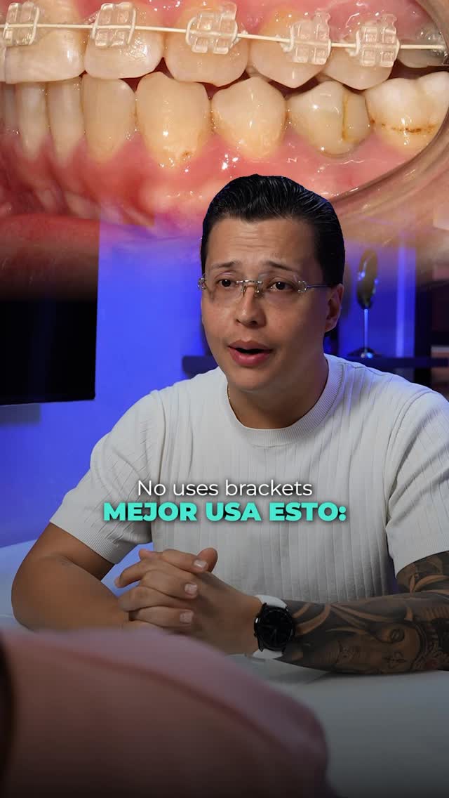 Alineadores ialign Facebook ad: No uses brackets cerámicos, mejor usa esto
