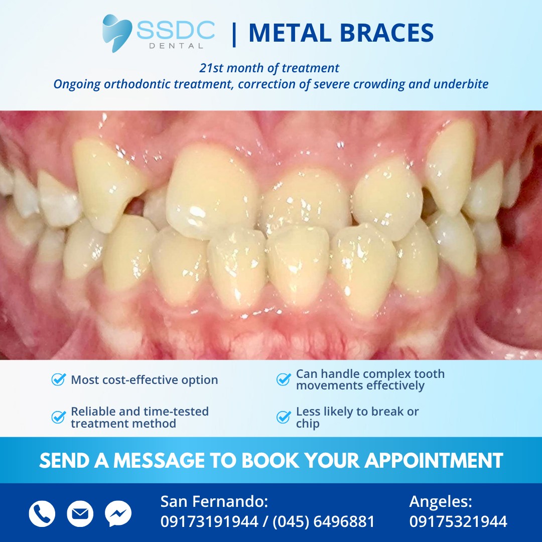 SSDC Dental Facebook ad