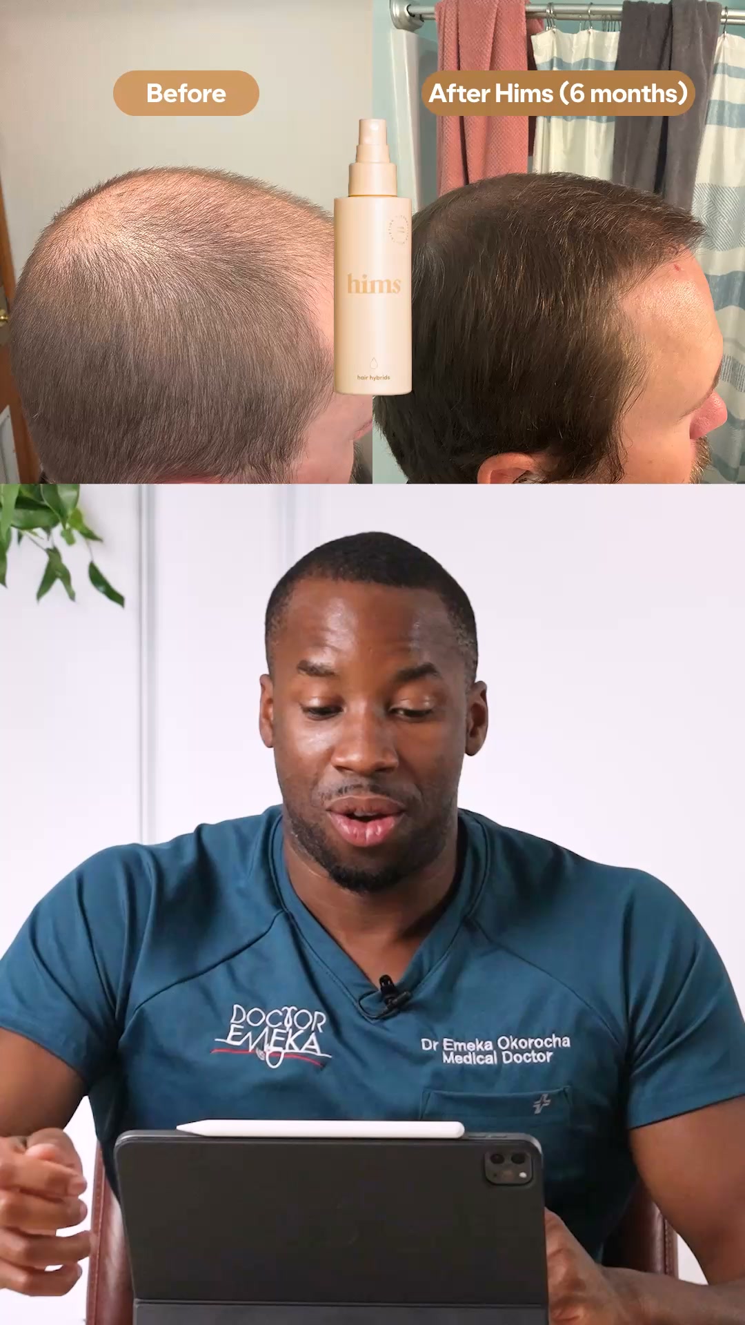 hims Facebook ad: Personalised Hair Regrowth Treatment