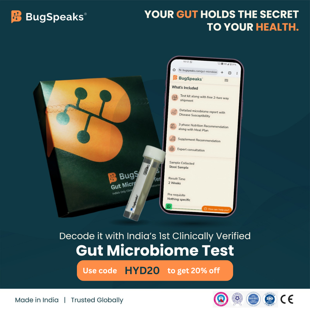 Bug Speaks Facebook ad