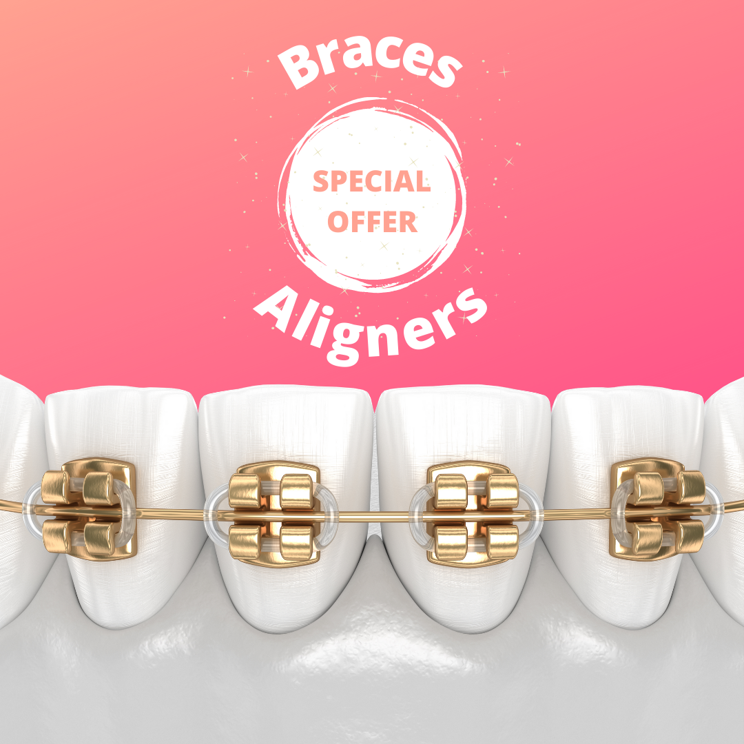 Dr Marc - Orthodontics at WA Dental Facebook ad: Braces & Aligners for $5,995-$7,995