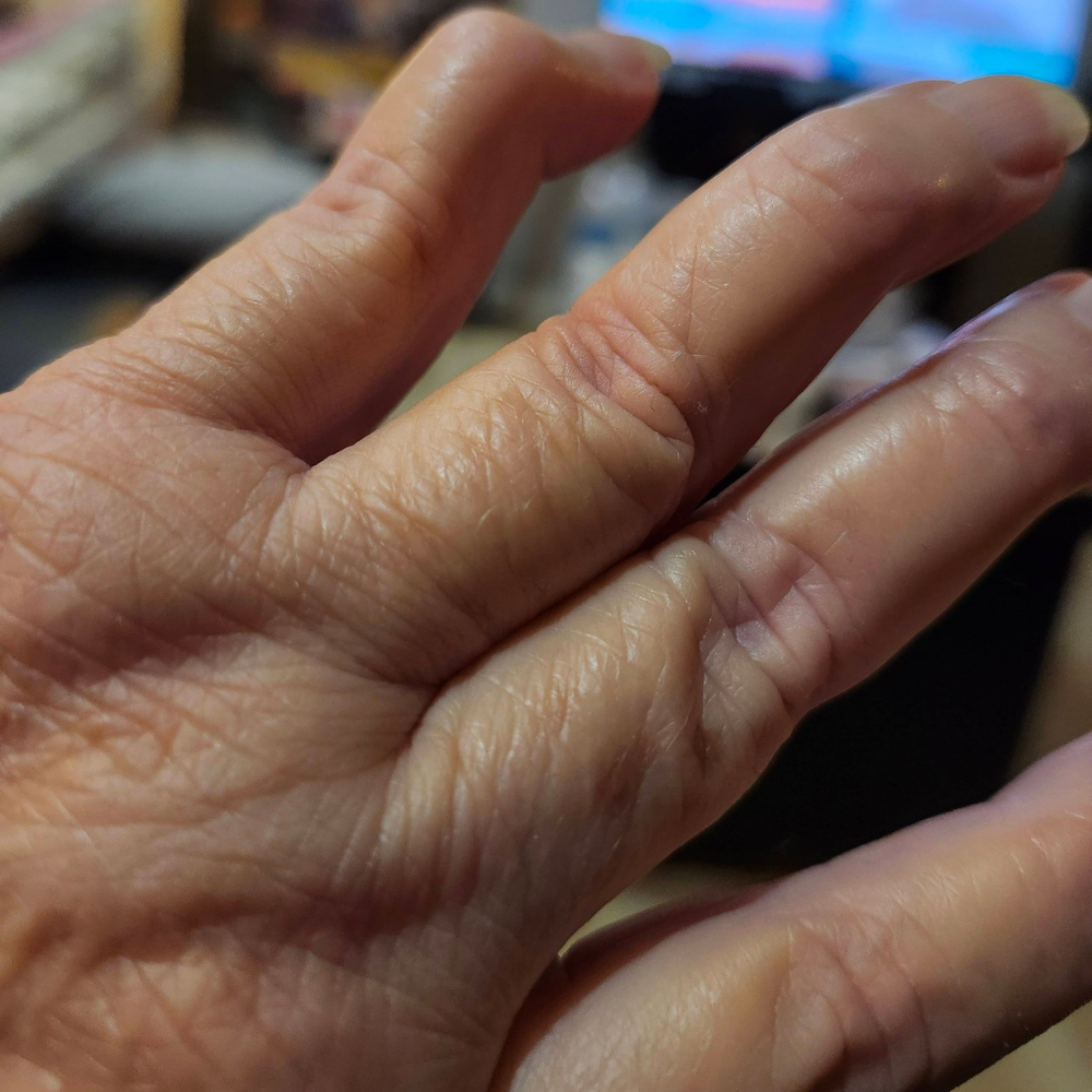 The Menopause Journal Facebook ad: Menopause did this to her hands
