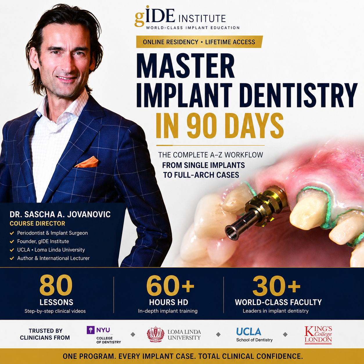 Implant Ninja Education Facebook ad: Master Implant Dentistry From Single Implants To Full-Arch…
