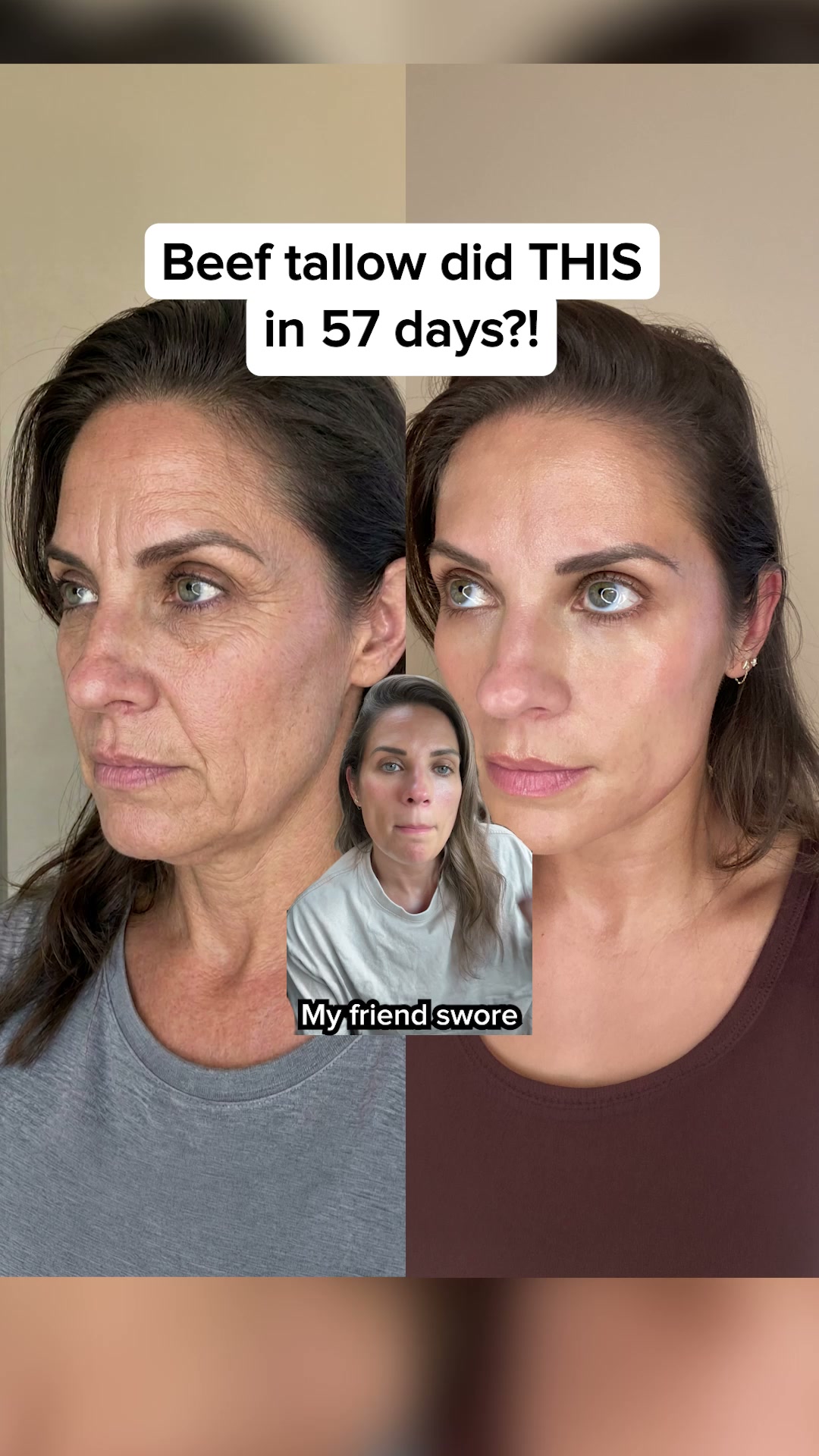Based Supplies Facebook ad: Restore Your Skin in 3 Weeks!