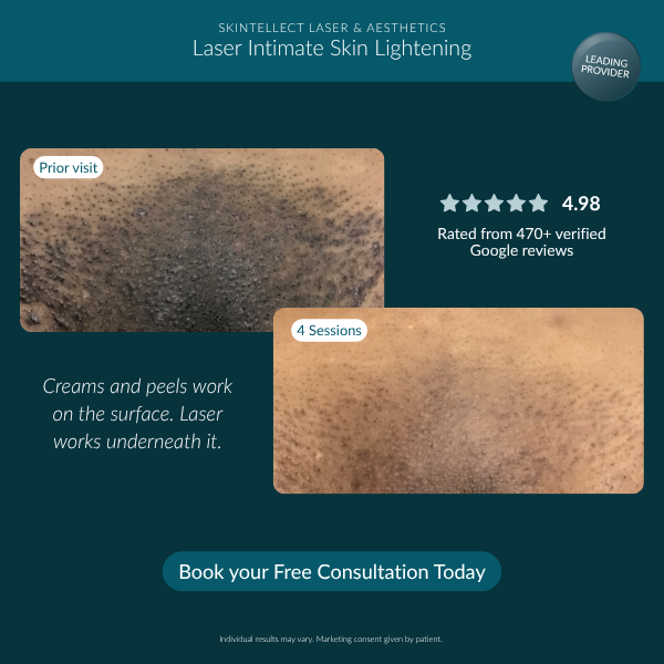 Skintellect Laser And Aesthetics Facebook ad from Jul 30, 2026