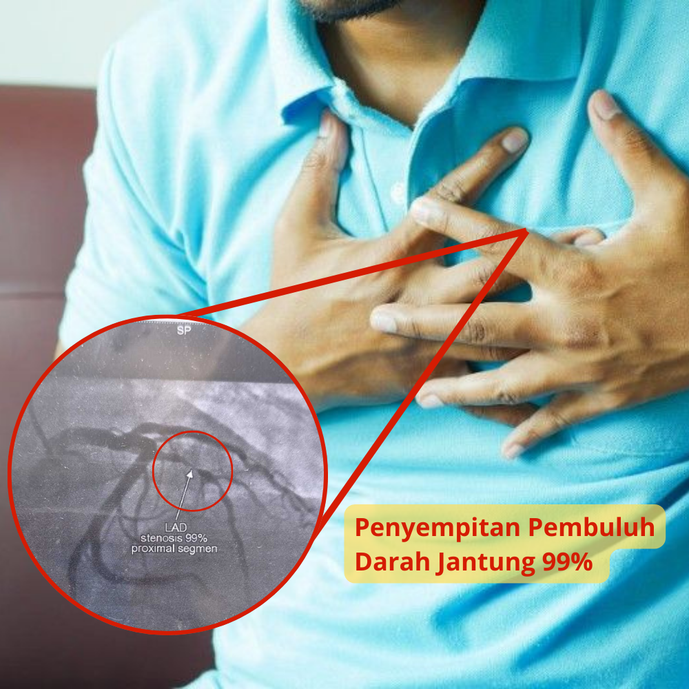 mGanik 3Peptide Edukasi Jantung Tensi Facebook ad
