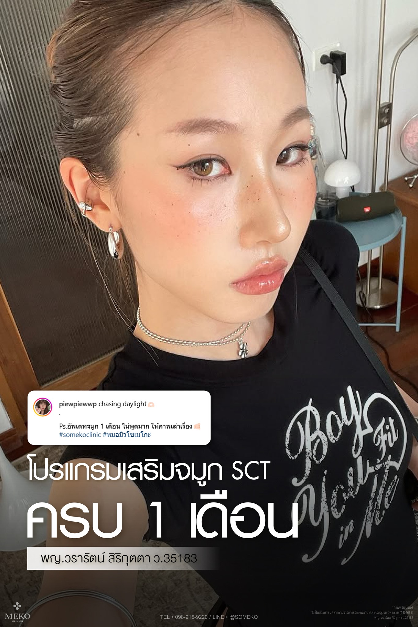 Someko โซเมโกะ Facebook ad: โปรแกรมเสริมจมูก SCT 1 เดือน (เสริมจมูกแบบ closed)…