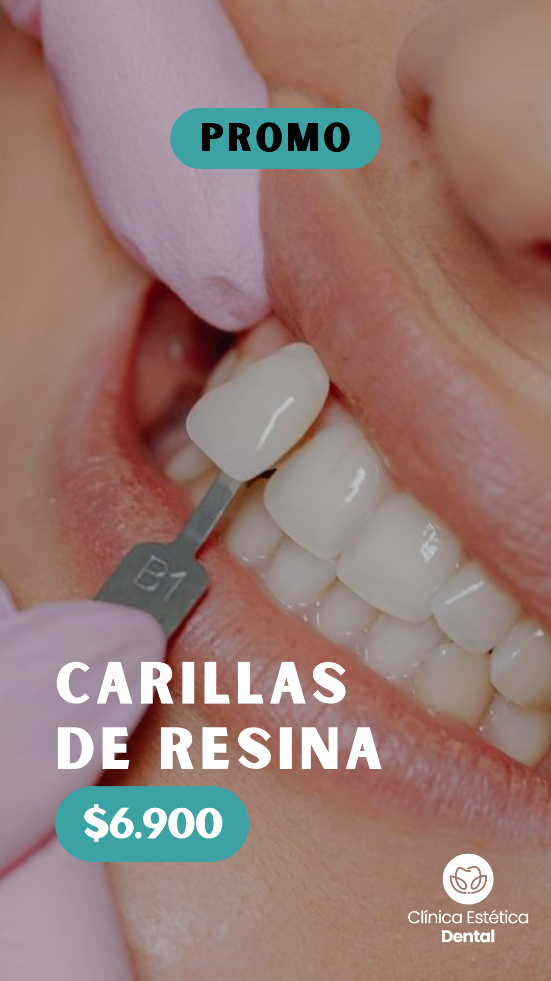 Clínica Estética Dental Facebook ad