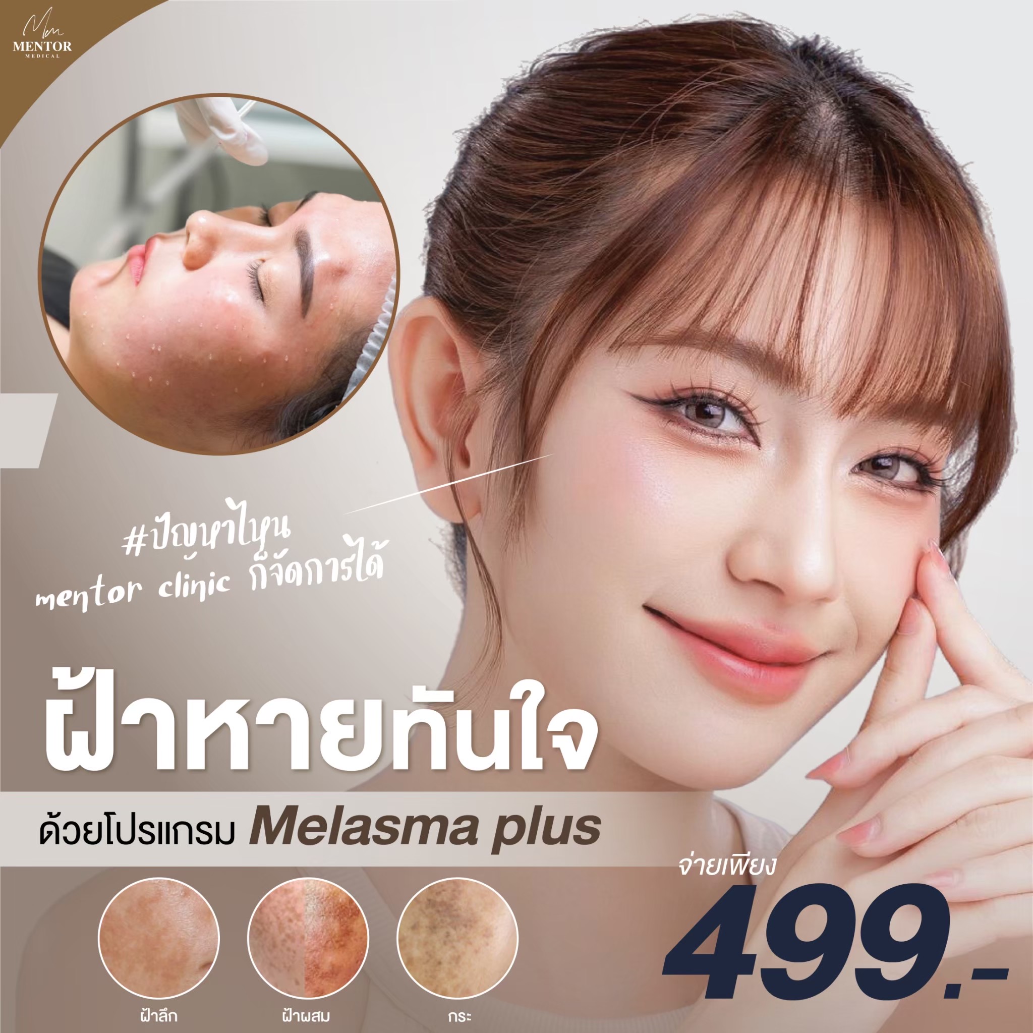 Mentor Medical Clinic Huahin Facebook ad: ปรึกษาฟรี
