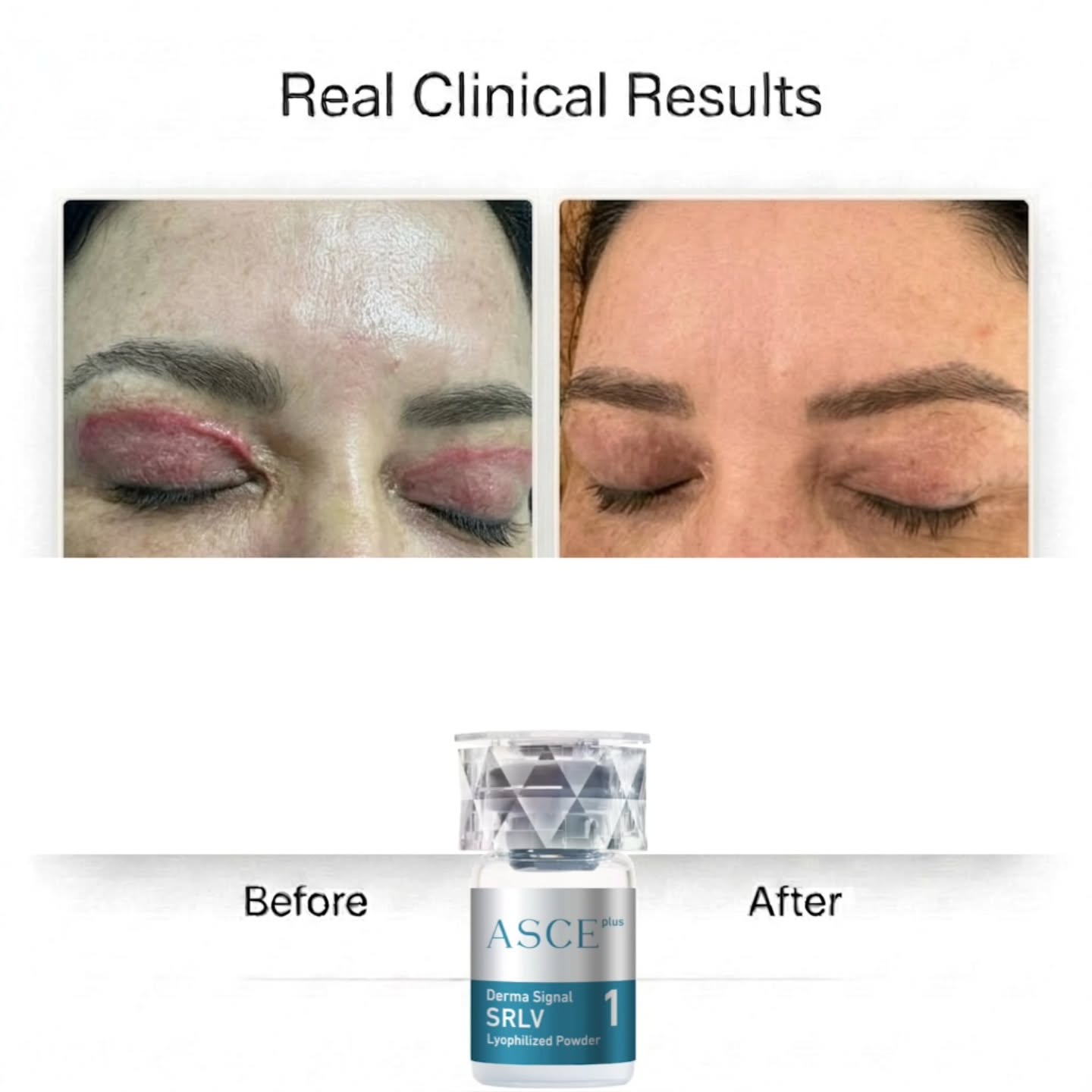 exosome_regen_med_aesthetics Facebook ad