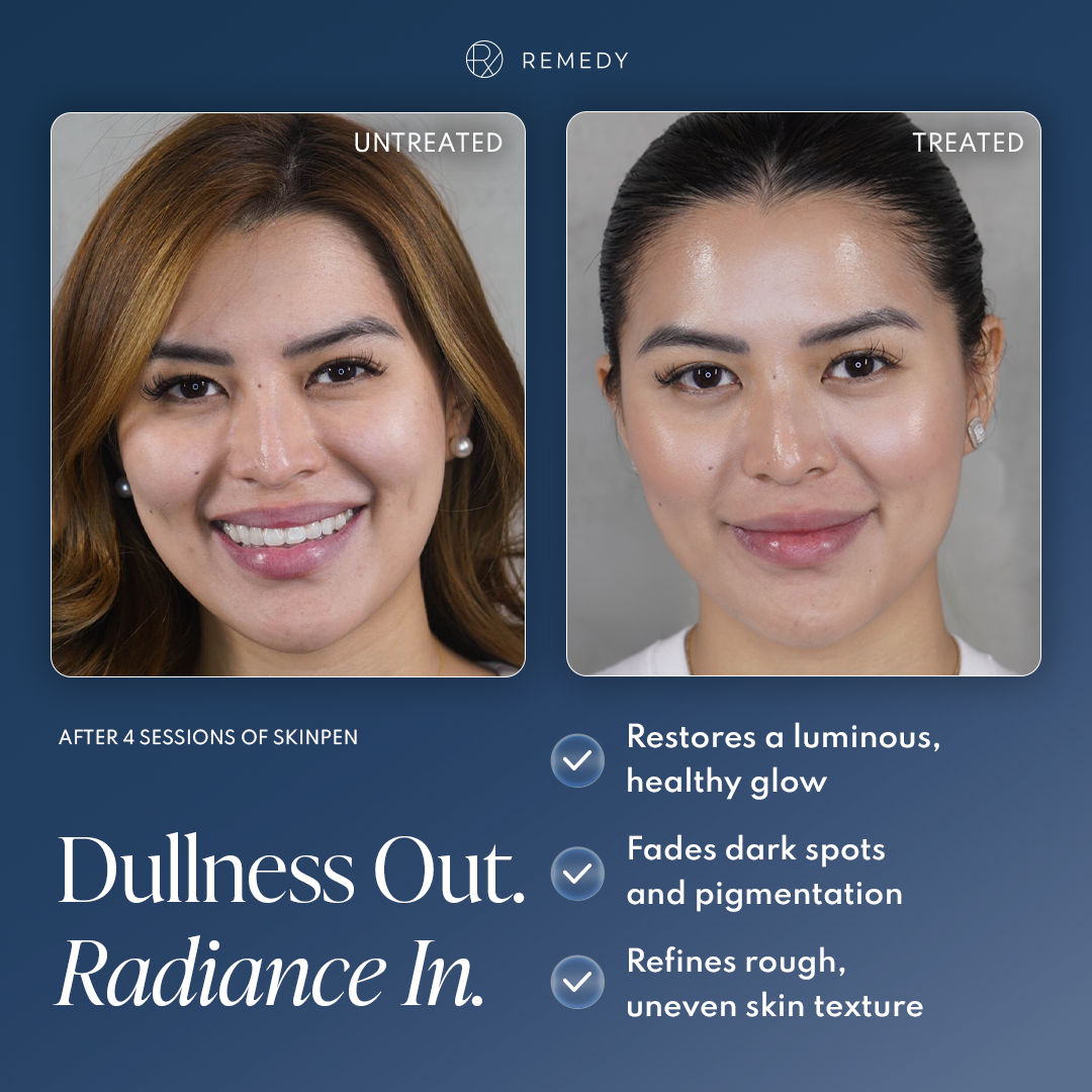 Remedy Skin Solutions Facebook ad