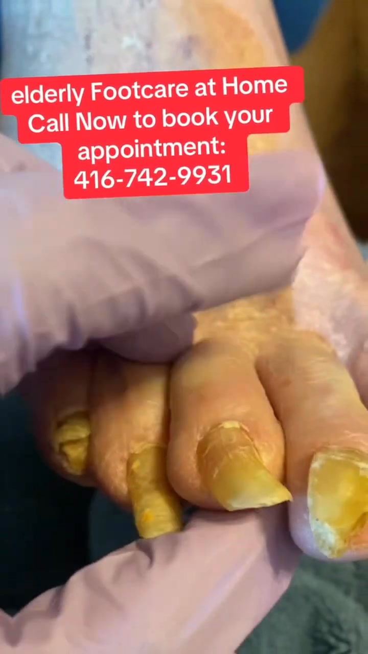 Footcarenursingwithgellis Facebook ad: nail care for seniors