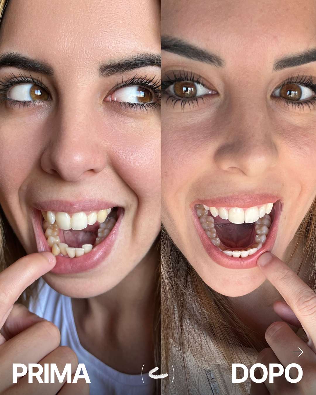 Impress_it Facebook ad: Sei adatto a portare l'apparecchio invisibile?