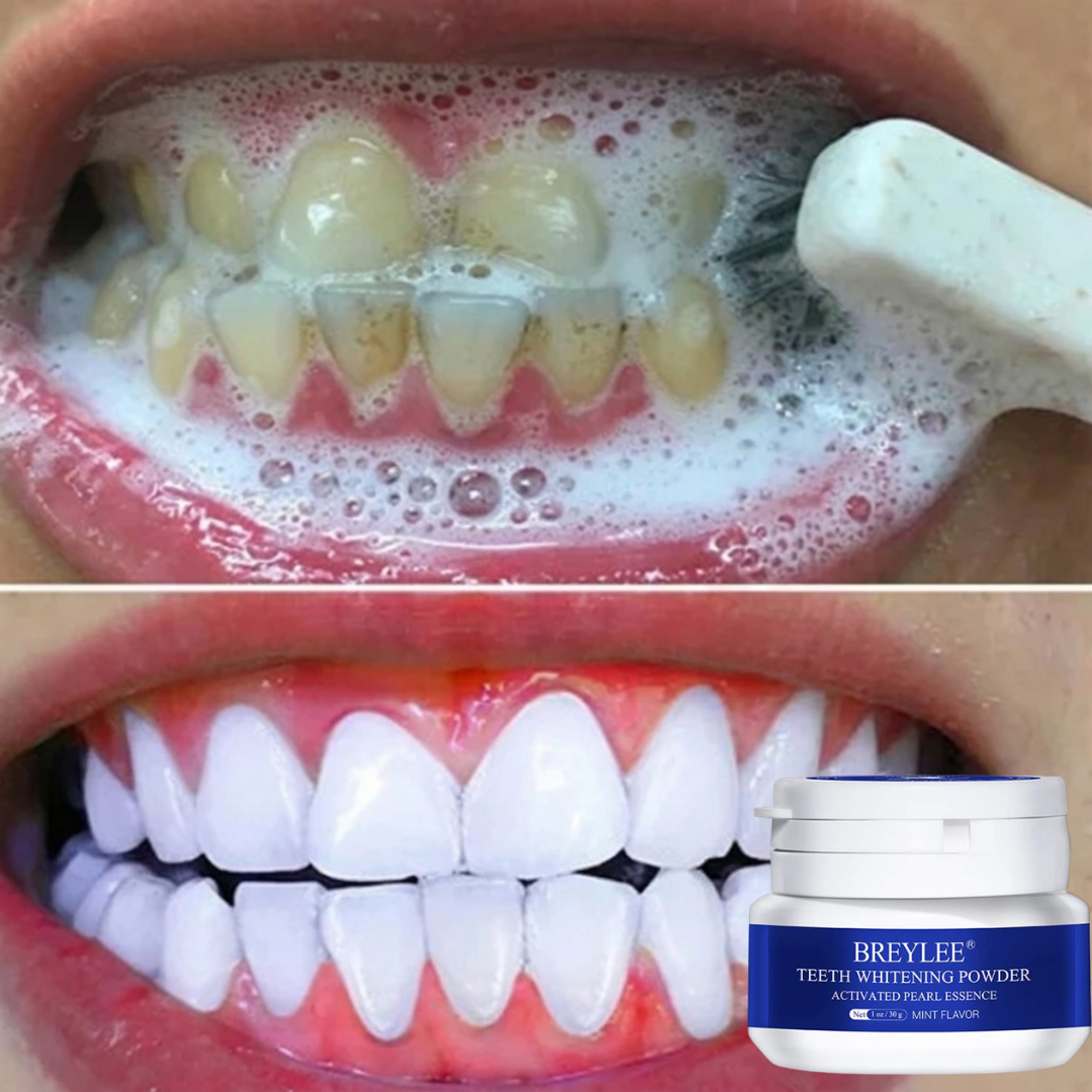 Grand Stores Facebook ad: This Is Why Your Teeth Are Still Yellow!