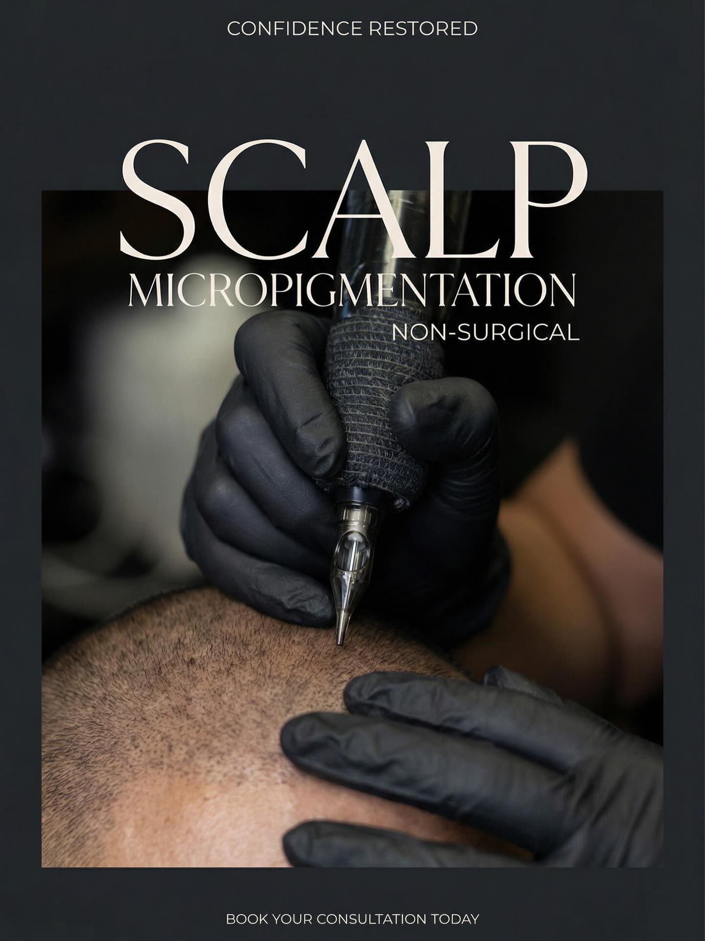 Madrid Inkd Facebook ad: Scalp Micropigmentation for Men & Women
