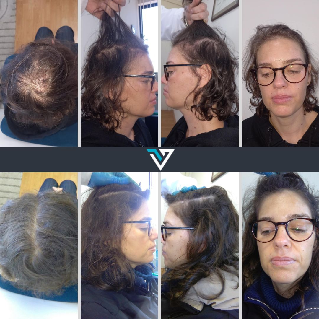 Vero Clinic - Tratamentos Capilares Facebook ad: Tratamento Capilar Mulher - Vero Clinic - Tratamentos…