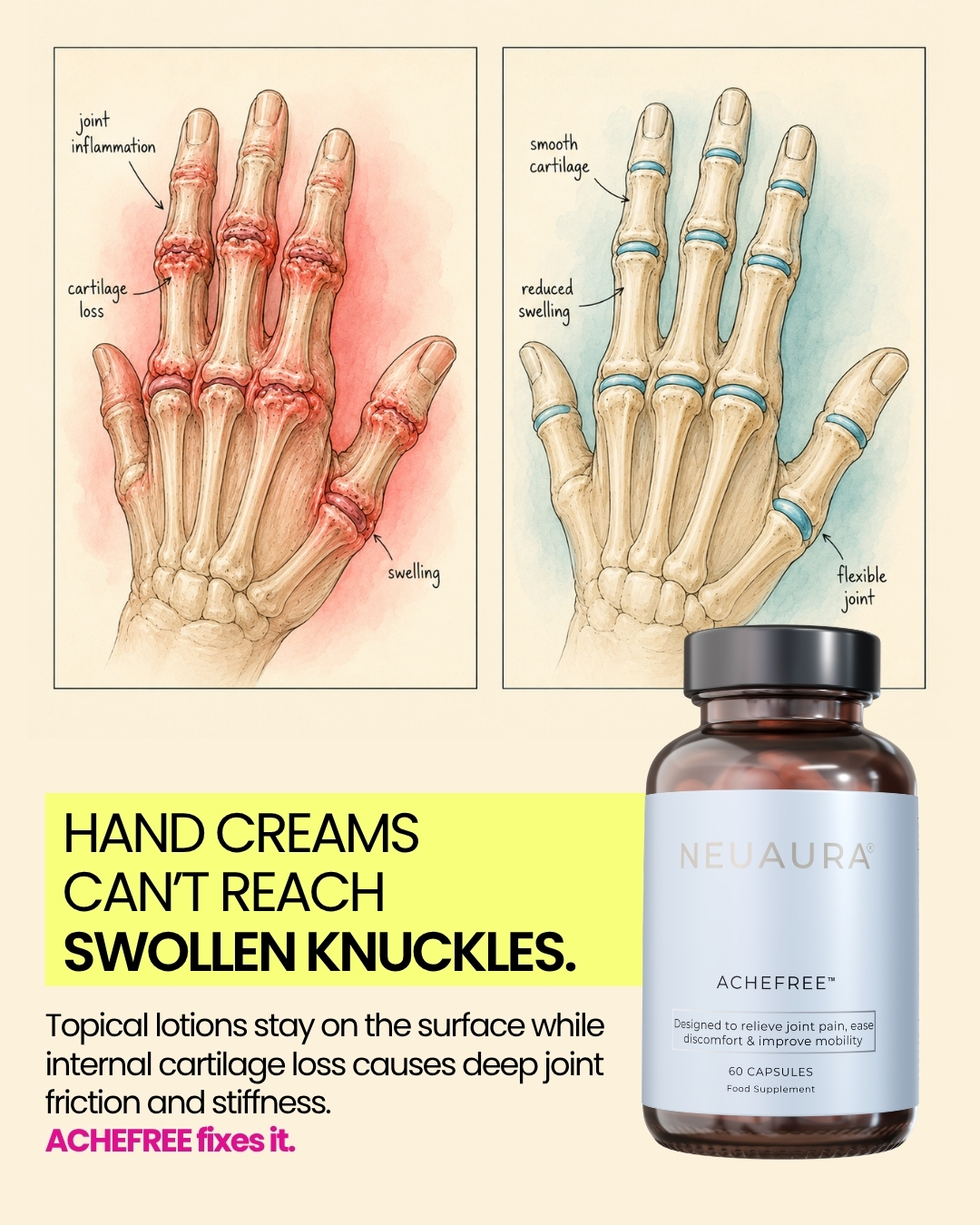 Neuaura Facebook ad