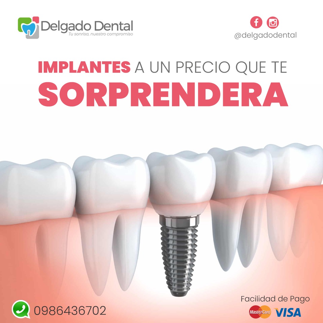 Delgado Dental Facebook ad: IMPLANTES A UN PRECIO QUE TE SORPRENDERA