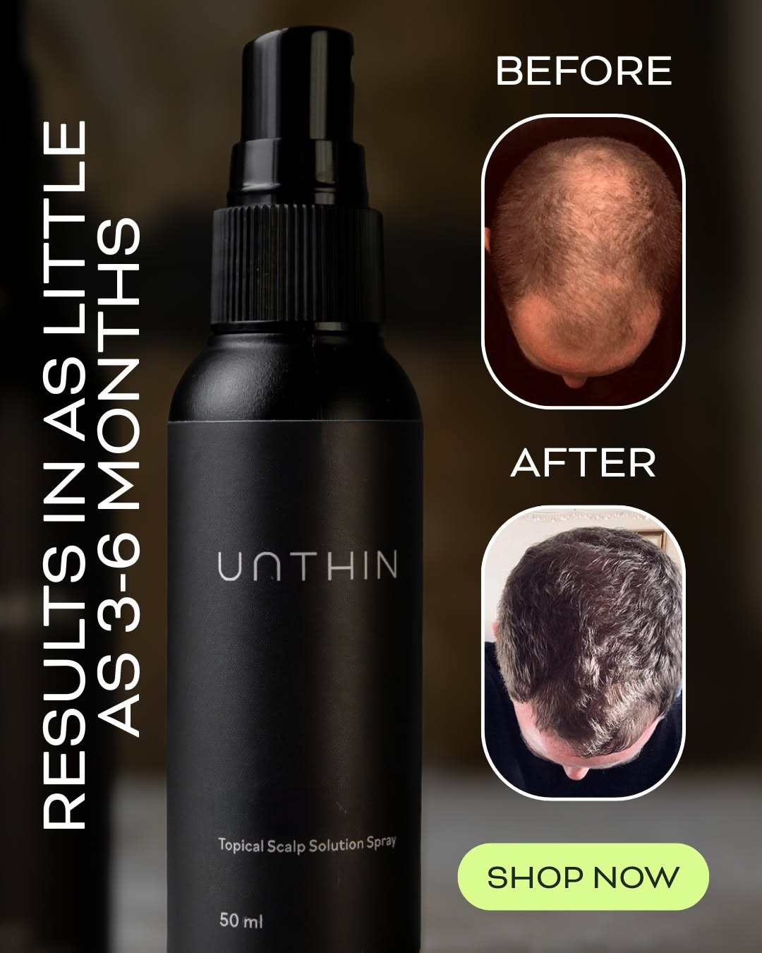 Unthinhair Facebook ad