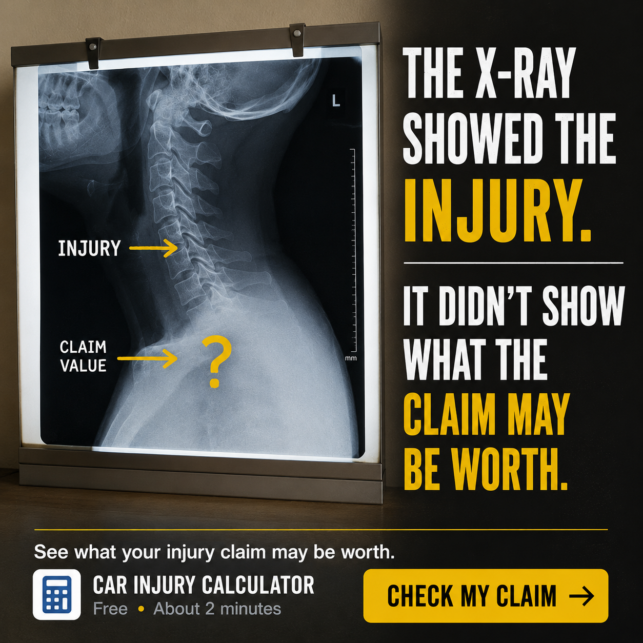 Car Injury Calculator Facebook ad