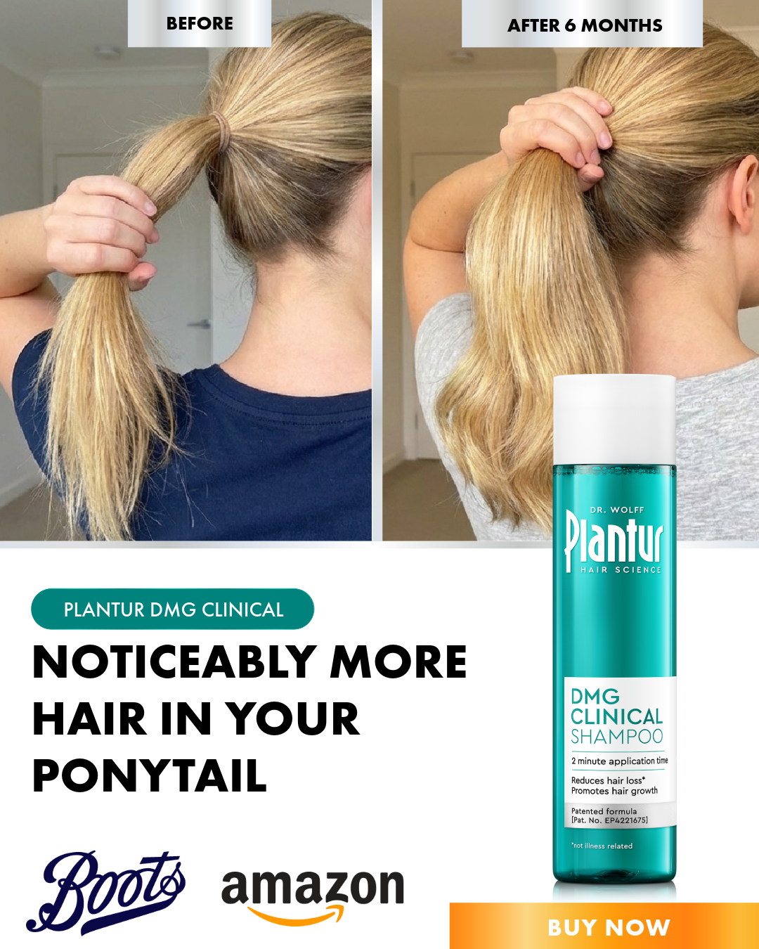 Plantur Facebook ad: Revolutionary active ingredient against hair loss*…