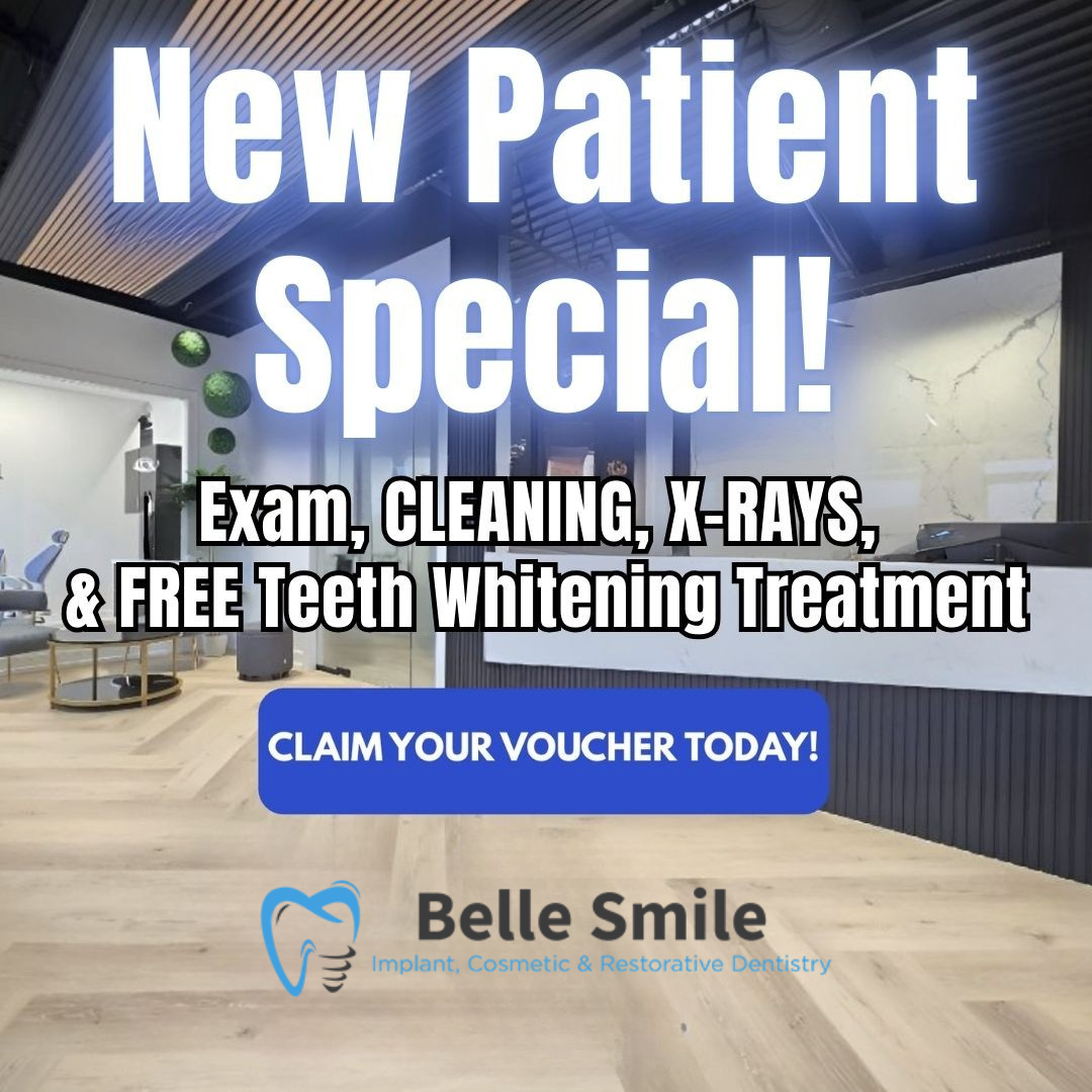 Belle Smile Dental Facebook ad: FREE Teeth Whitening Kit