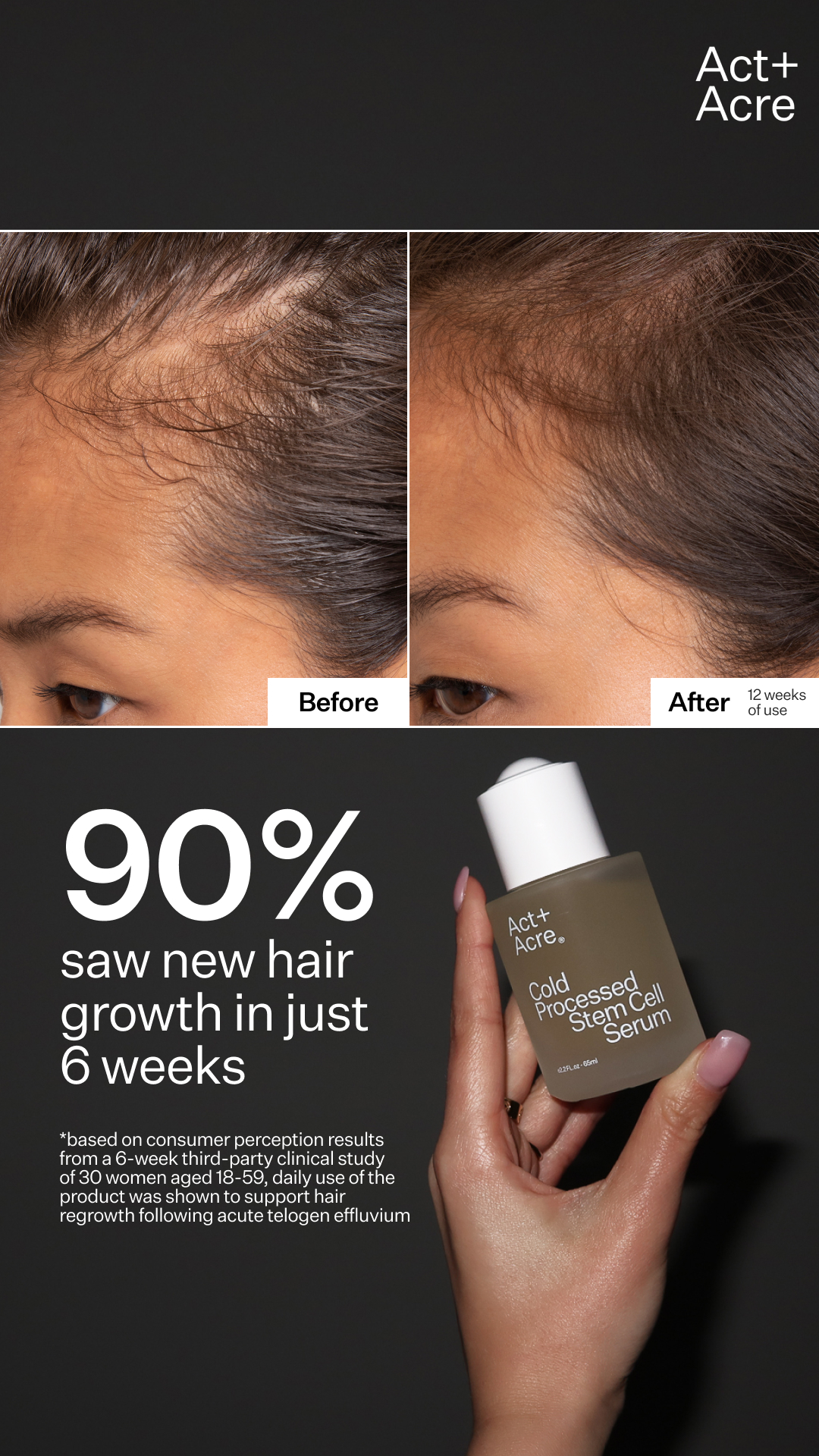 ActandAcre Facebook ad
