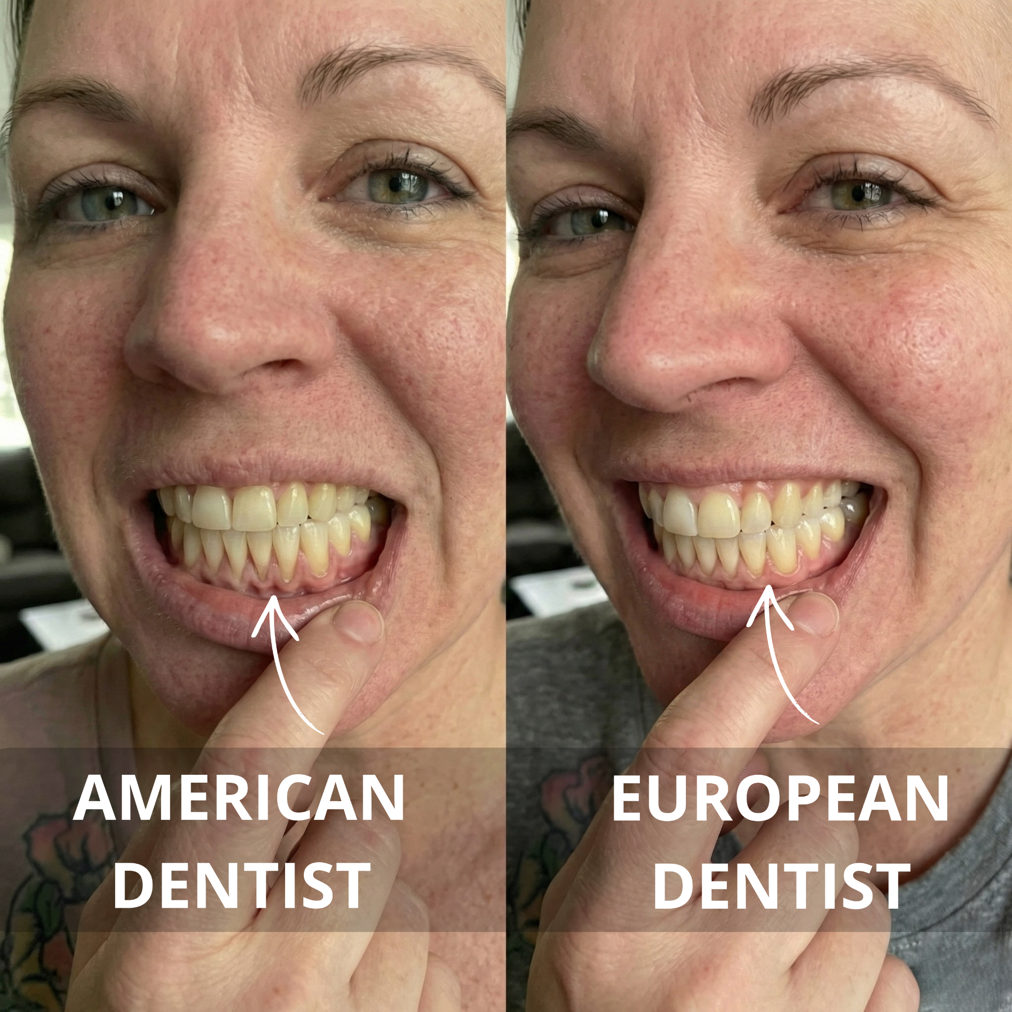 Carol Patterson Facebook ad: Read this if your gums are receding