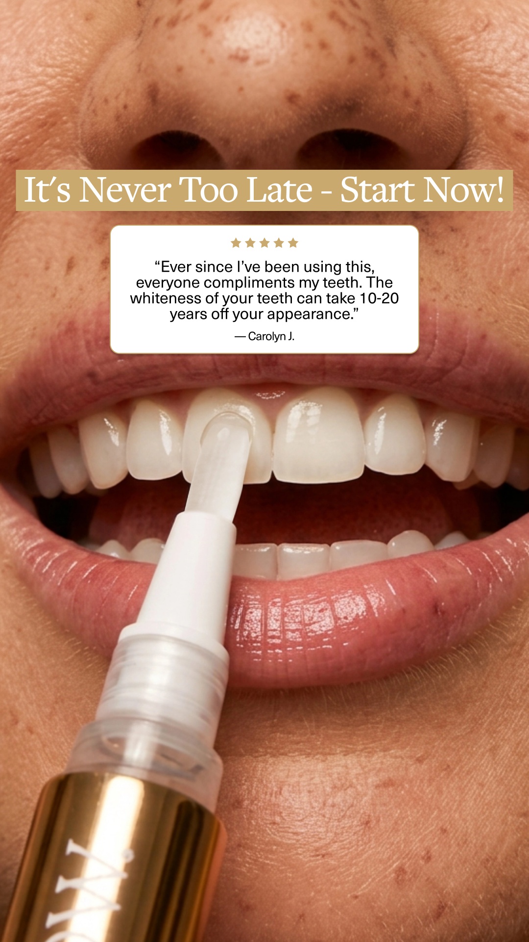 SNOW Teeth Whitening Facebook ad
