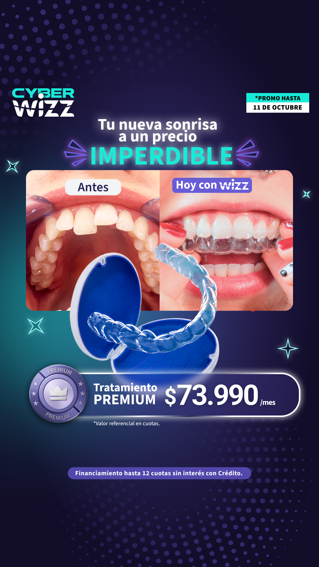Wizz Chile Facebook ad: Corrige tu sonrisa con alineadores invisibles guiados por…
