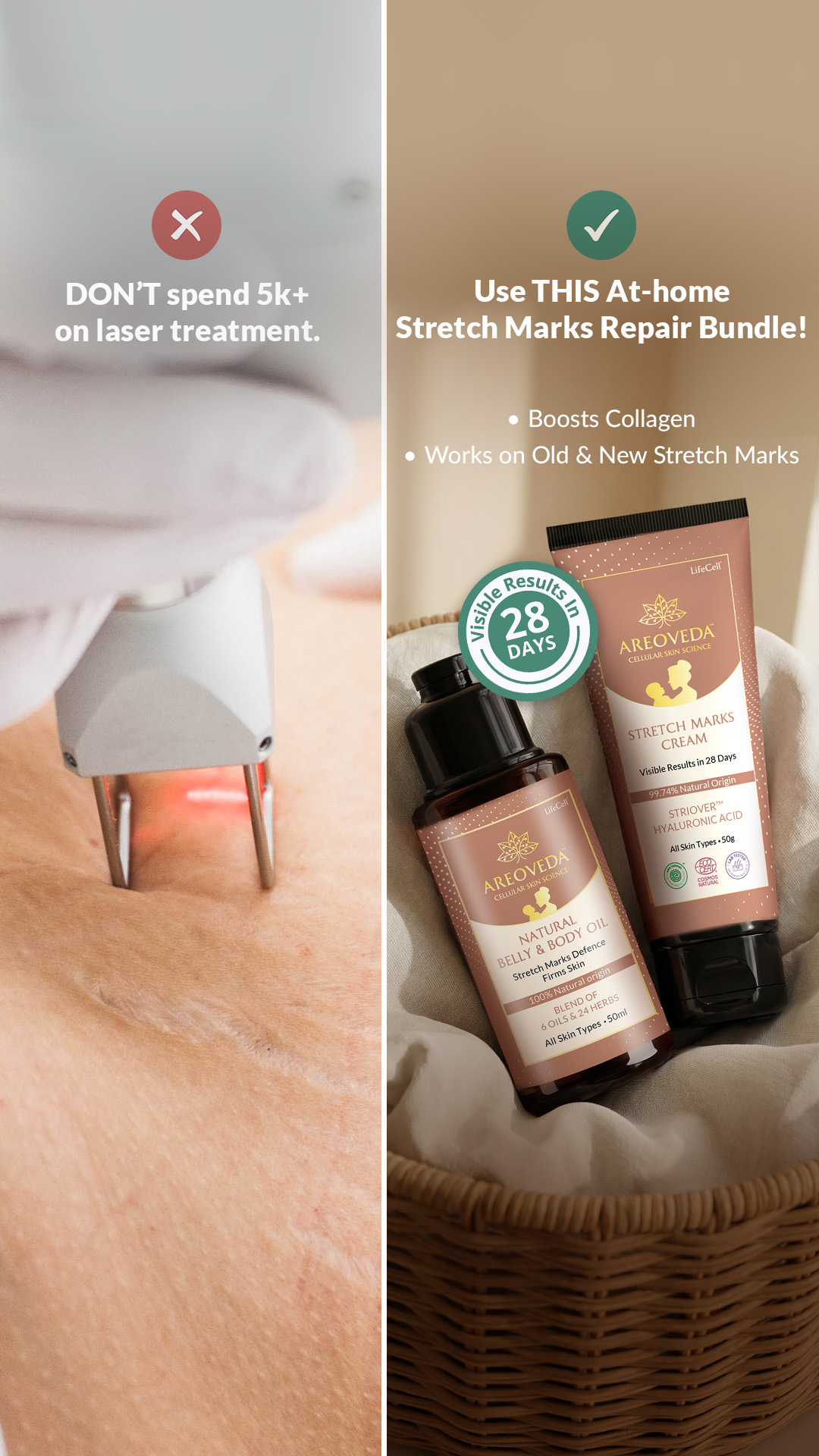 AreoVeda Facebook ad