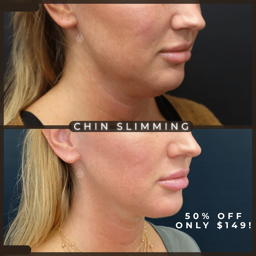 First Look Med Spa, LLC Facebook ad from Mar 3, 2026