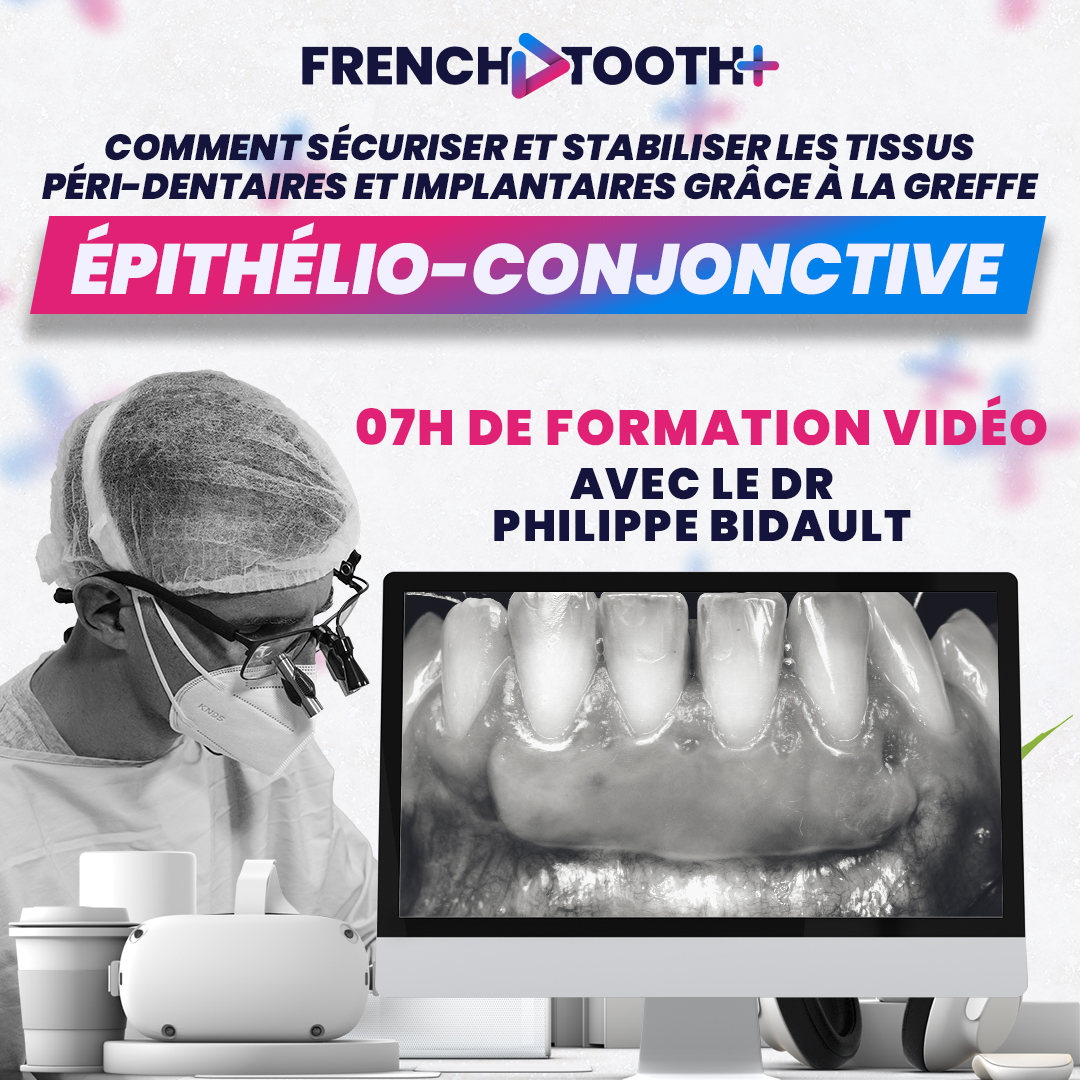 French Tooth Facebook ad