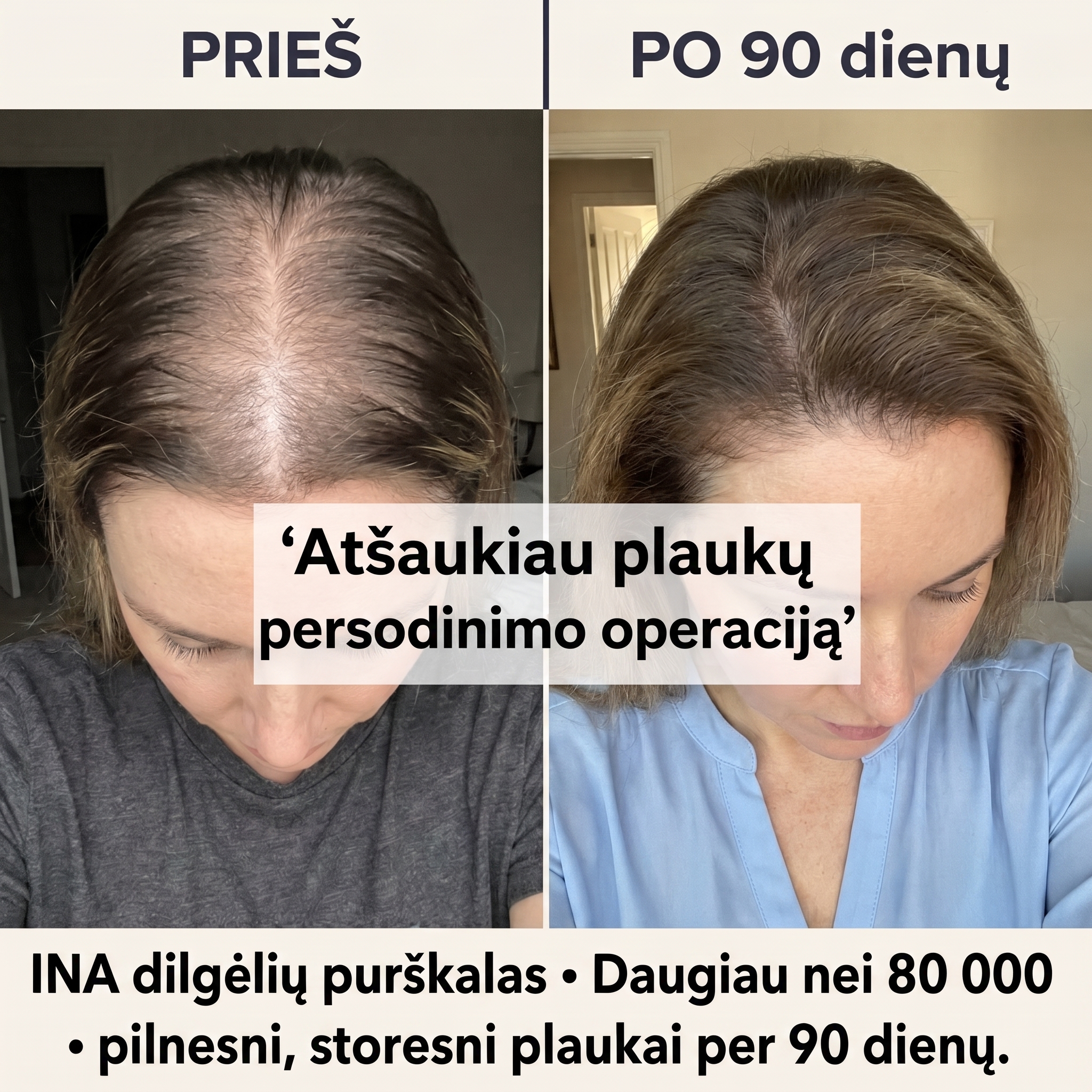 Organinė Kosmetika - InaEssentials.LT Facebook ad: Ji atšaukė plaukų transplantaciją per 90 dienų