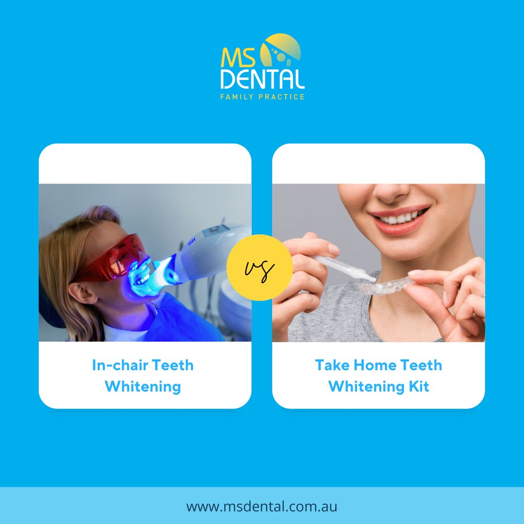 MS Dental - Family Practice Cardiff Facebook ad: Thinking about teeth whitening but not sure which…