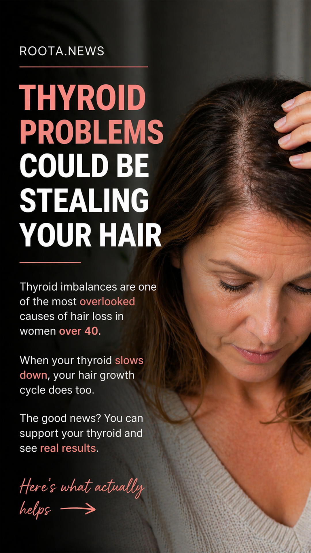Roota Facebook ad: If You’re Seeing More Scalp, Read This