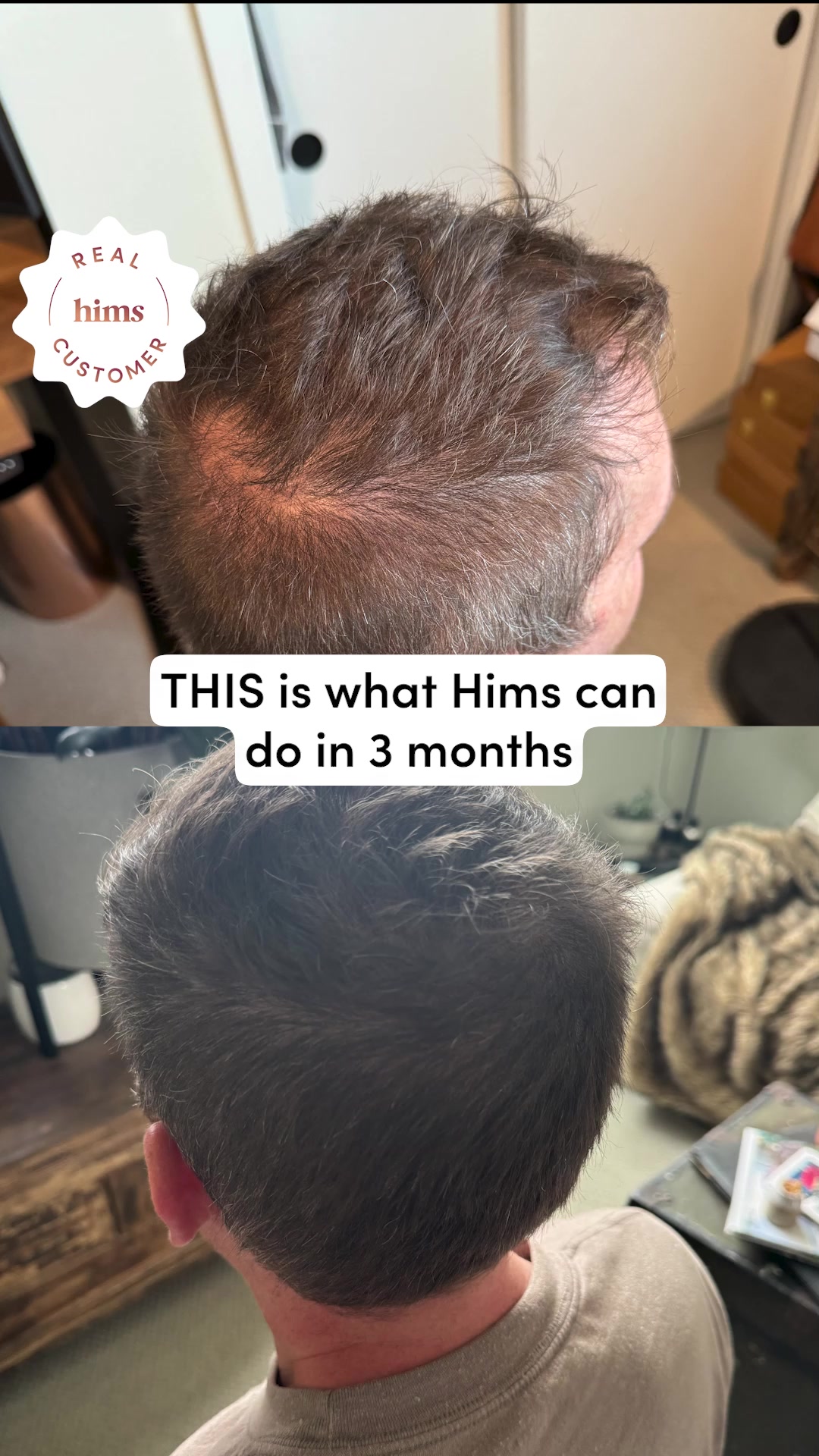 hims Facebook ad: Take control of hair loss today