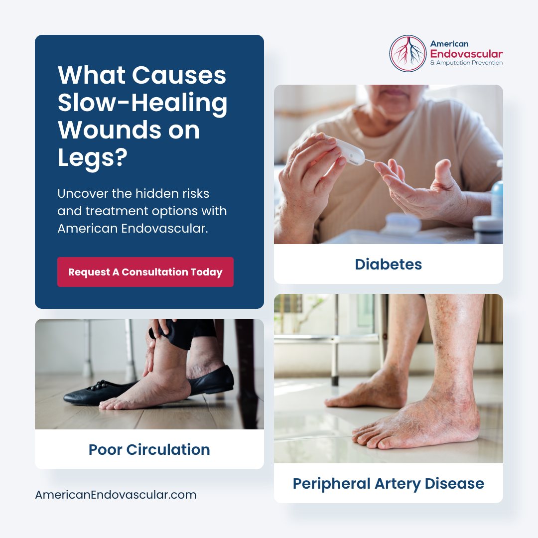 American Endovascular & Amputation Prevention Facebook ad