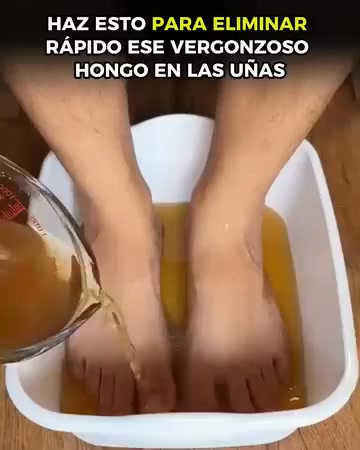 Vitalia Colombia Facebook ad: Para uñas amarillas o con dolor