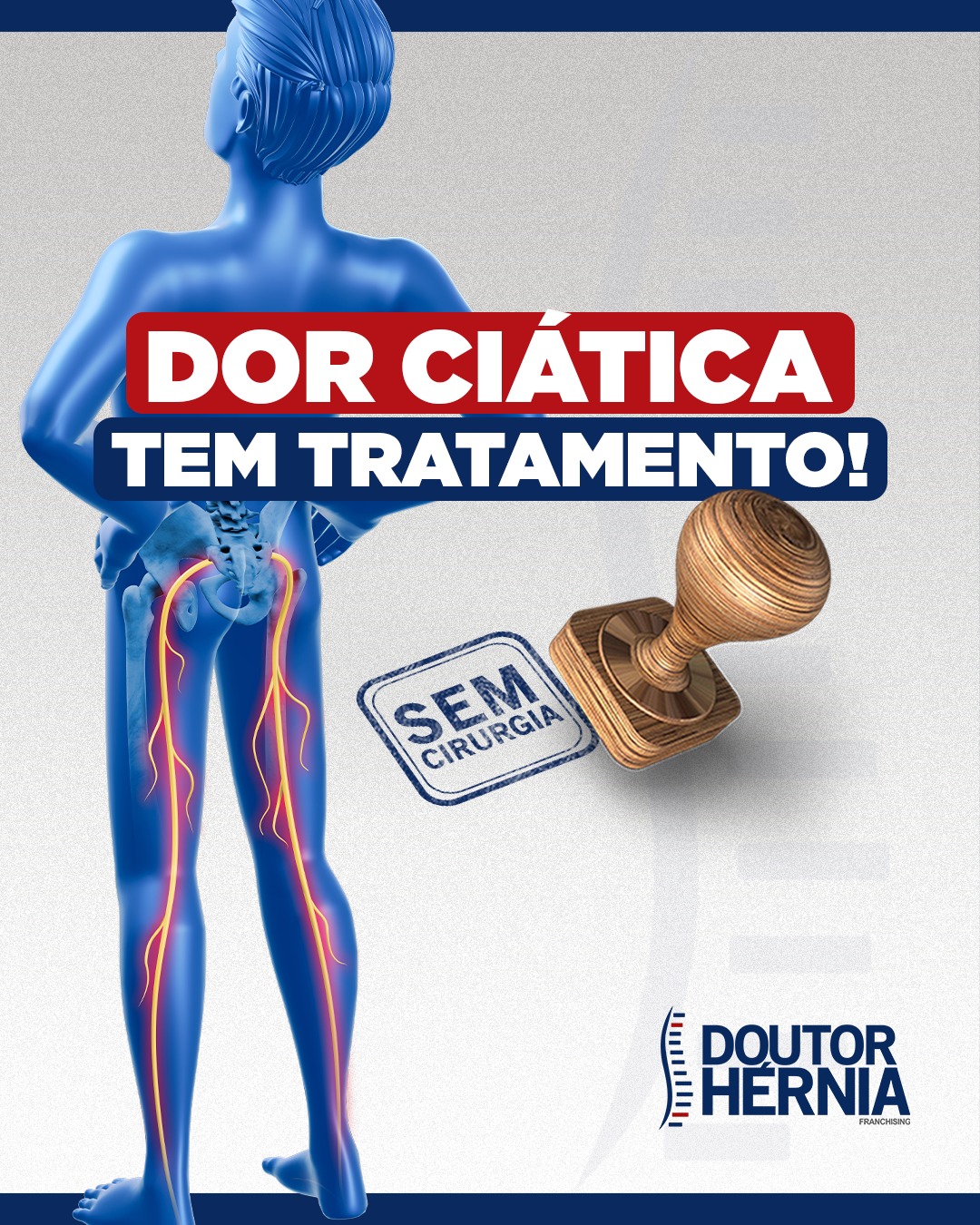 Doutor Hérnia Unidade Concórdia Facebook ad: A dor que desce da lombar até a…