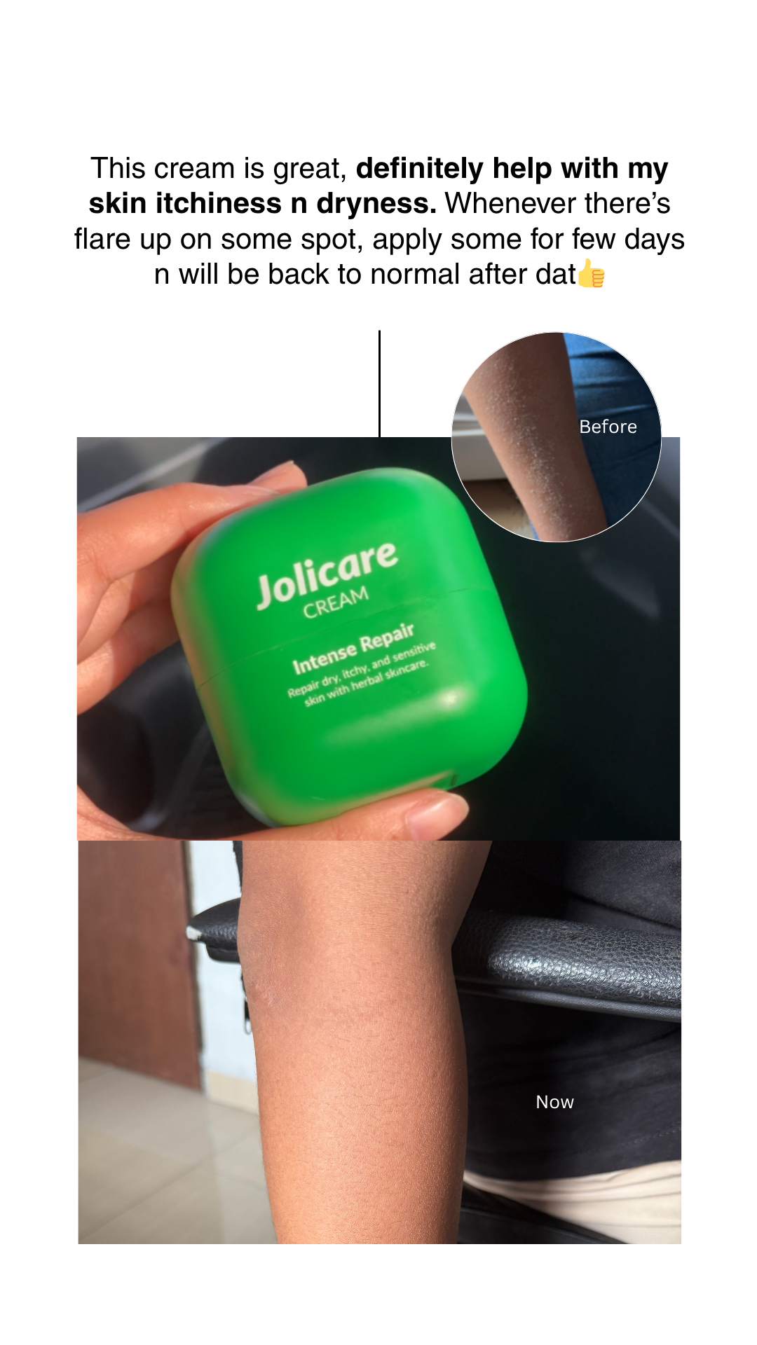 Jolicare - Repair Dry, Itchy & Sensitive Skin Facebook ad