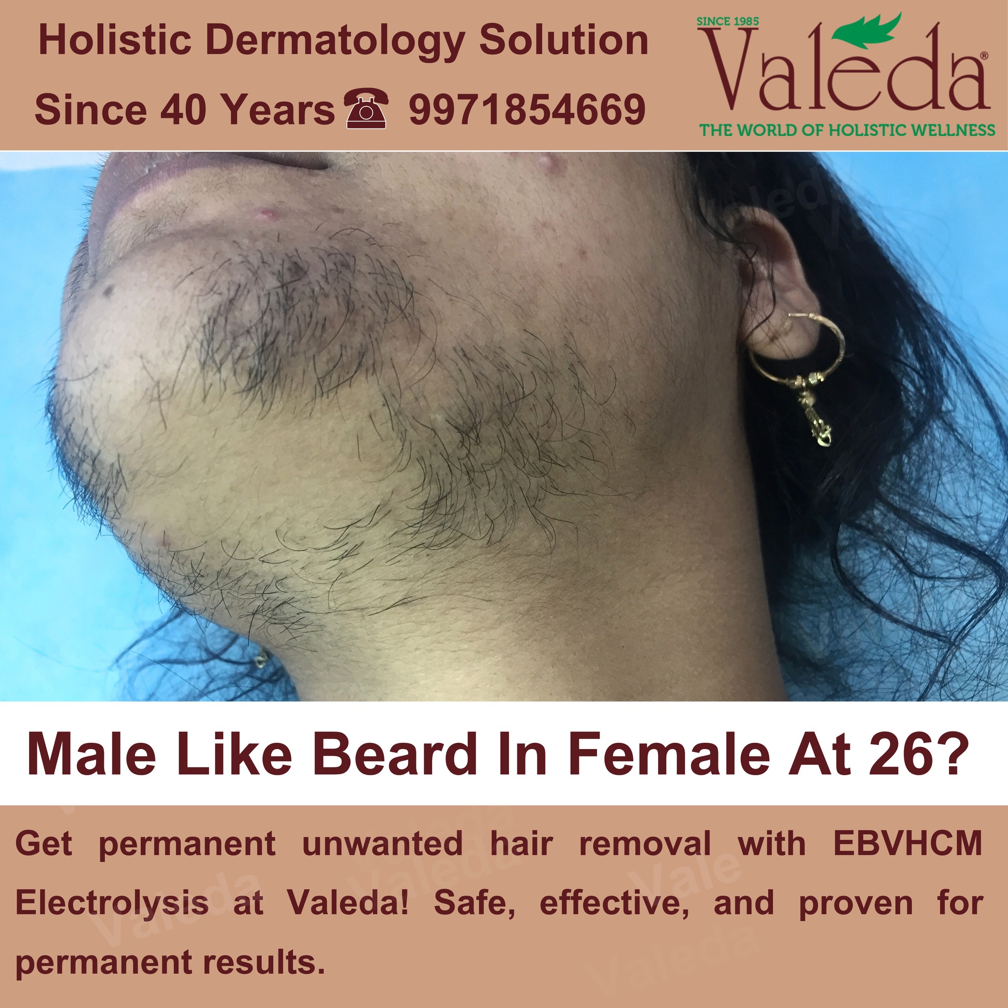 Valeda - The World of Holistic Wellness Facebook ad: Male-Like Beard in Female at 26?