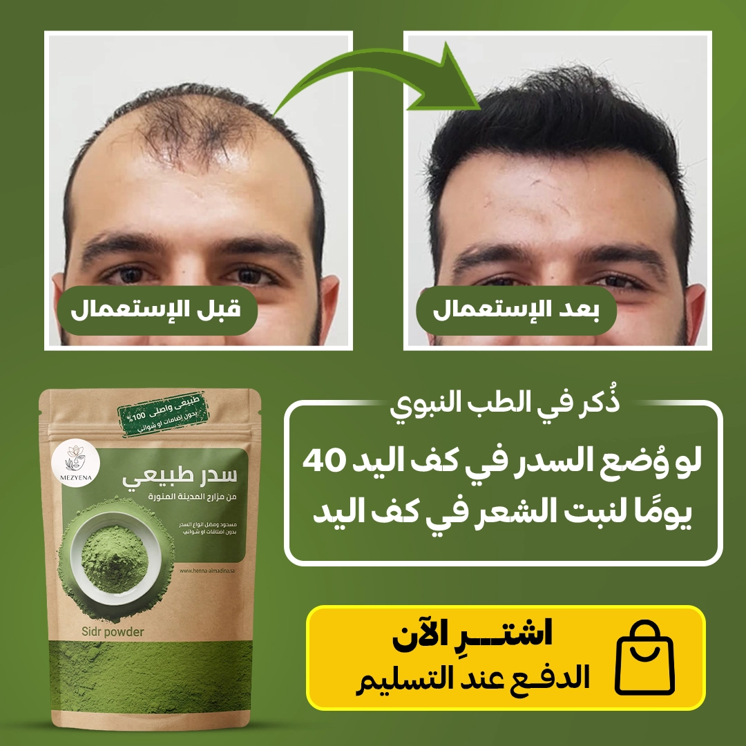 Mezyena Facebook ad: السدر… سرّ من أسرار الطب النبوي لشعرك
